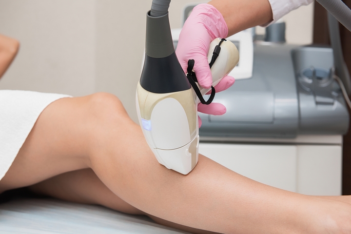 laser hair removal for all